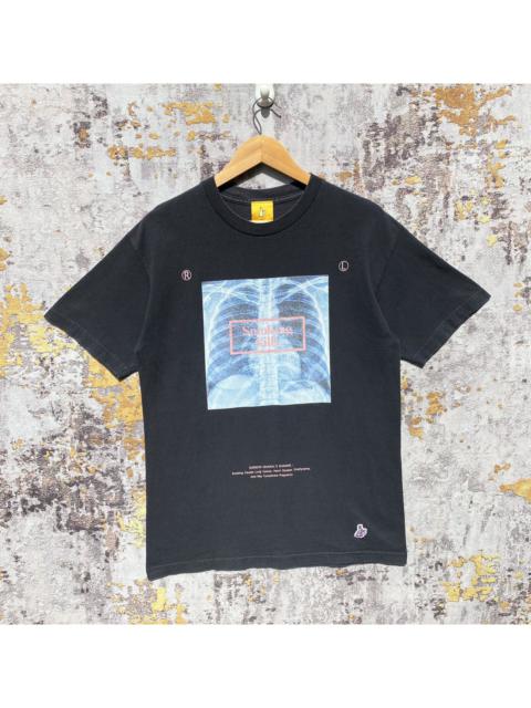FR2 Smoking Kills X-RAYS Shirt FR2 Sunfaded