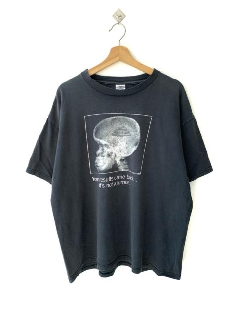 Other Designers Vintage - Vintage Head Skulls “it’s not a tumor” Tee