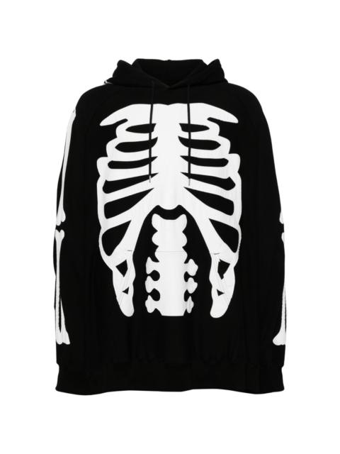 bone patch two-tone hoodie