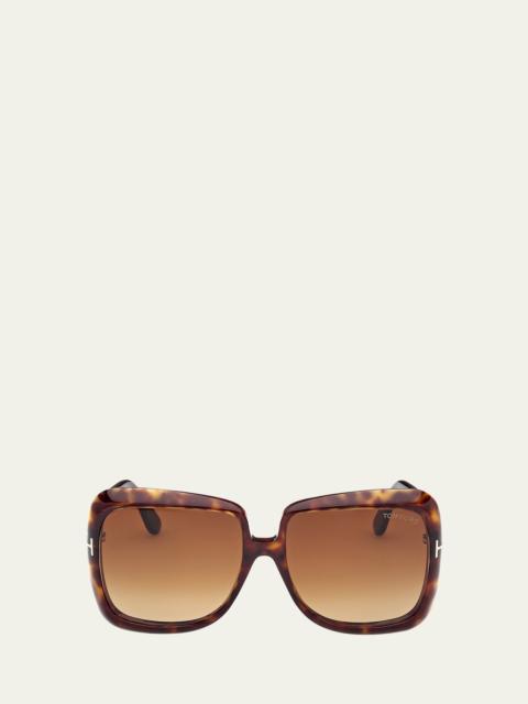 Lorelai Acetate Square Sunglasses